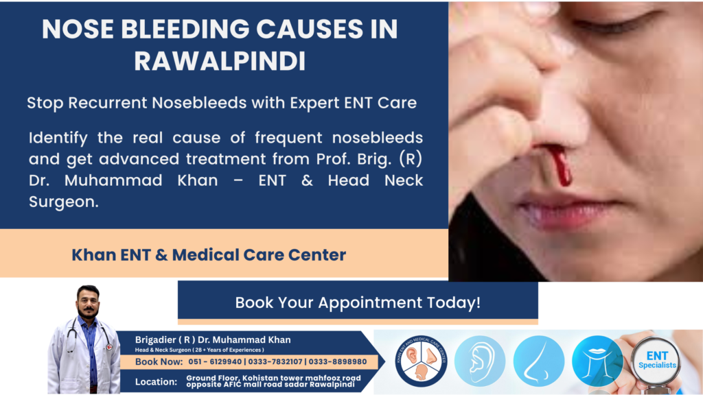 Nose Bleeding Causes in Rawalpindi