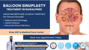 Balloon Sinuplasty