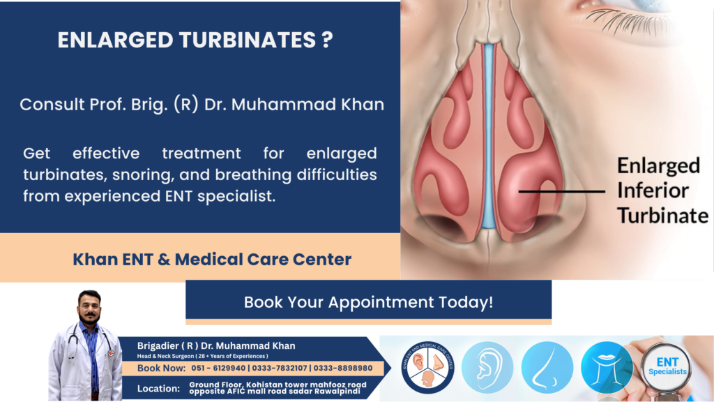 Enlarged Turbinates Treatment in Rawalpindi