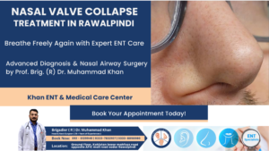 Nasal Valve Collapse