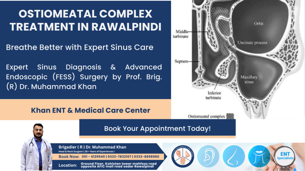 Ostiomeatal Complex Treatment in Rawalpindi