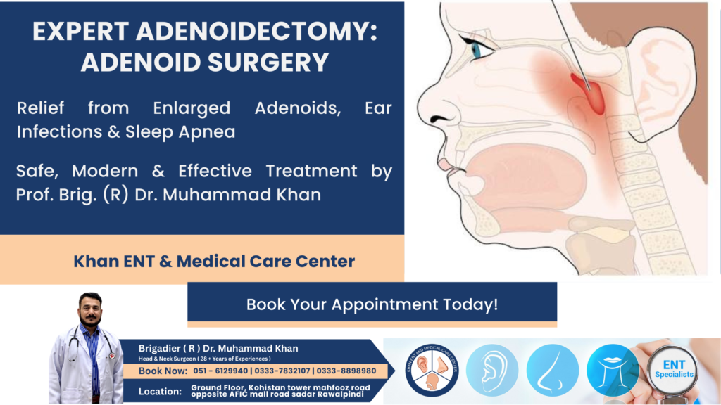 Adenoidectomy: Adenoid Surgery