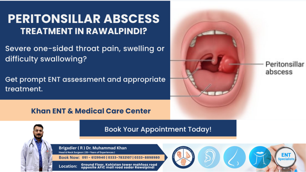 Peritonsillar Abscess Treatment in Rawalpindi
