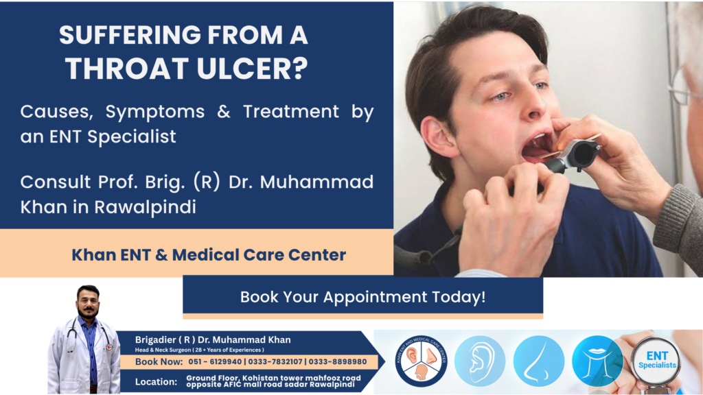 Throat Ulcers Causes, Symptoms, Treatment, Prevention in Rawalpindi