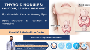 Thyroid Nodules Symptoms, Causes & Treatment