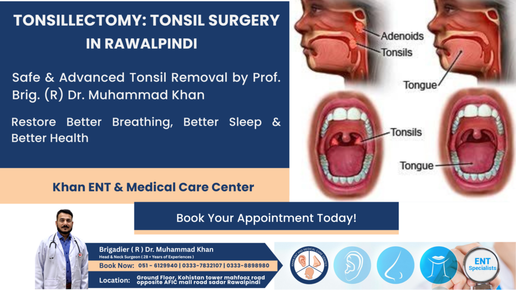 Tonsillectomy Tonsil Surgery in Rawalpindi.