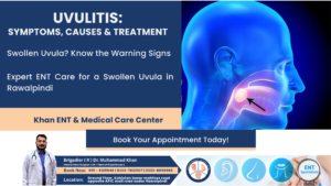 Uvulitis Symptoms, Causes & Treatment