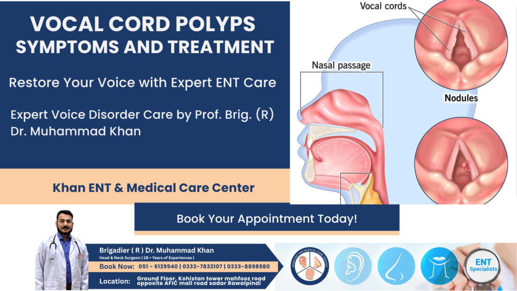 Vocal Cord Polyps Symptoms and Treatment