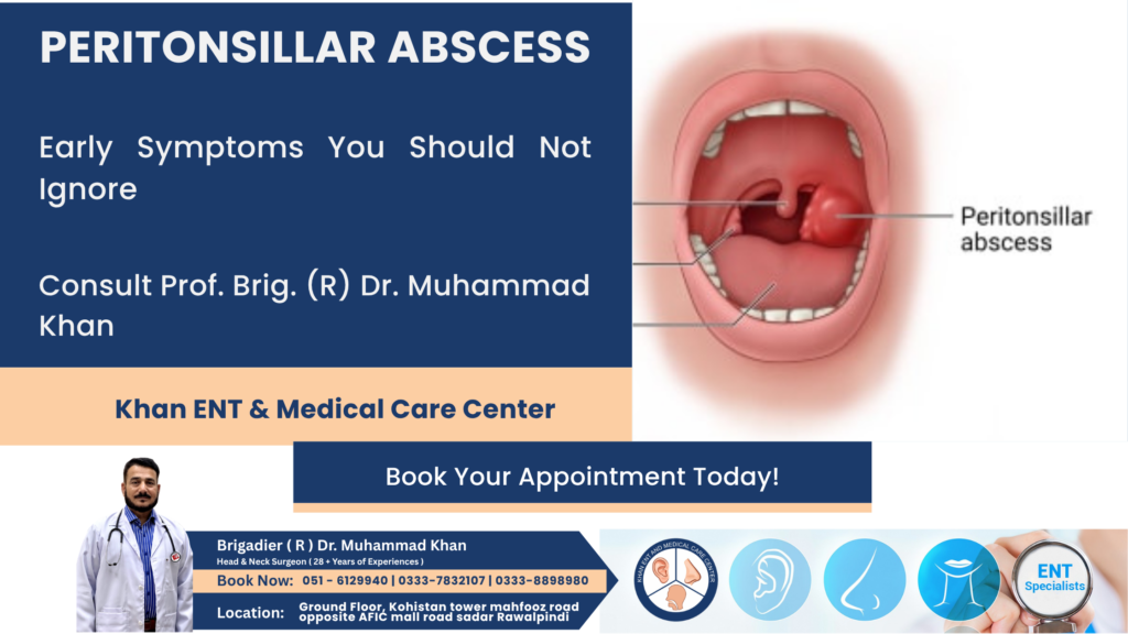 Peritonsillar Abscess Symptoms, Causes and Treatment in Rawalpindi