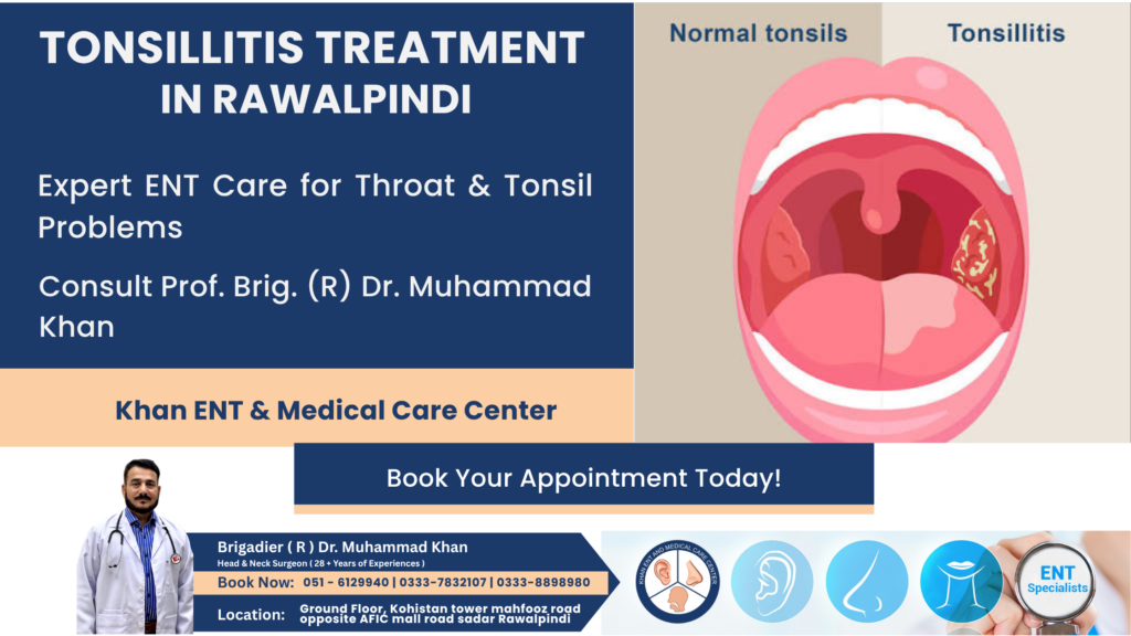 Option A Tonsillitis Treatment in Rawalpindi