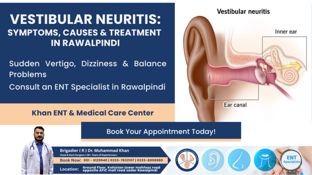 Vestibular Neuritis Symptoms & Treatment